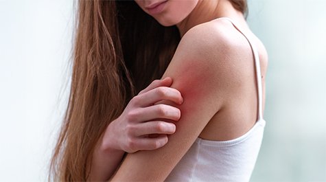 Aké sú najčastejšie druhy ekzému a ako ich rozpoznať?