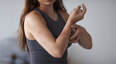 Čo je dermatitída a ako spoznať, že sa týka práve vás