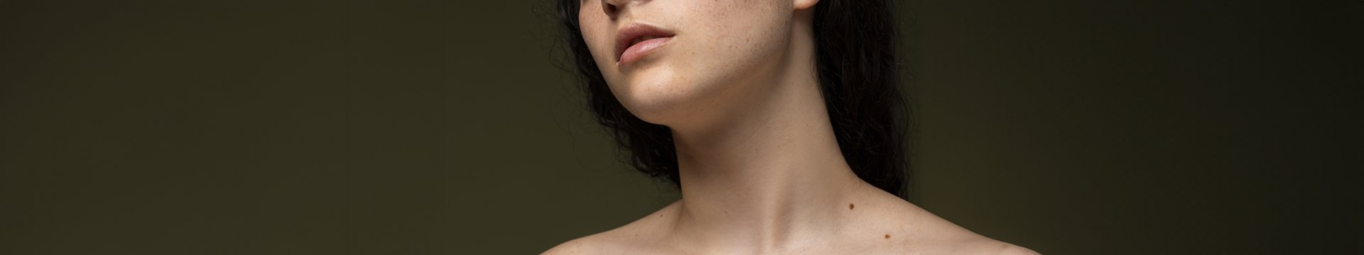 Hnedé škvrny na koži a ako sa ich zbaviť  Header