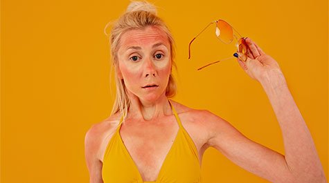 Čo pomáha pri spálení od slnka?