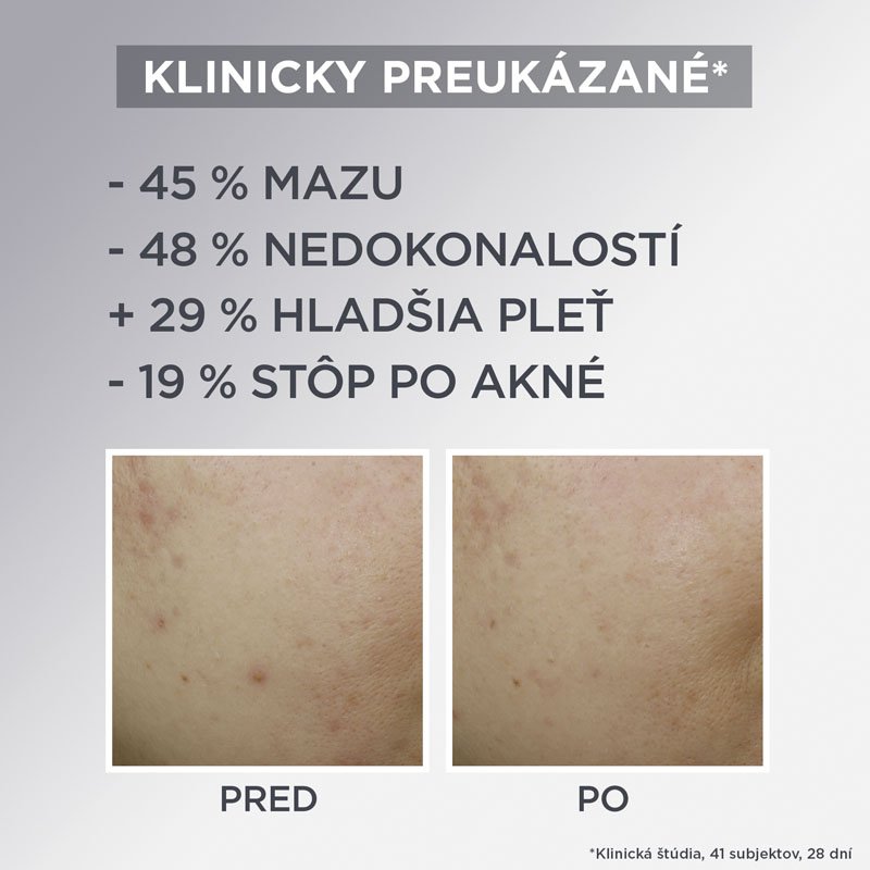 Pure Active AHA + BHA ľahký denný zmatňujúci krém 3v1 s aktívnym uhlím - 8