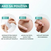 Hydrokoloidné neviditeľné náplasti na nedokonalosti s BHA - 4