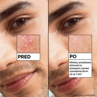 GARNIER Pure Active Salicylic Sérum proti nedokonalostiam - 8